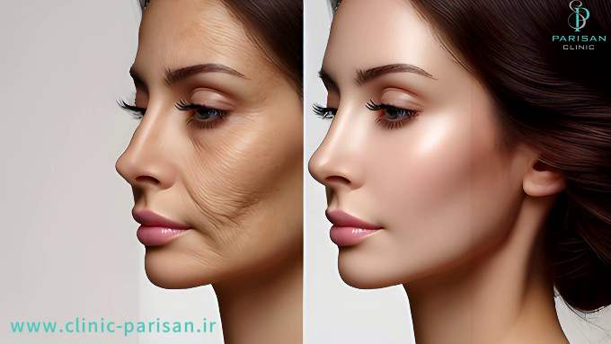 skin rejuvenation